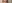 裏ハムラ法（経結膜的眼窩脂肪移動術） — プレジャー美容外科クリニック