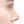 Nasal osteotomy (nasal bone narrowing) — after (7days) · Pop Plastic Surgery Clinic