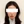 顔面非対称の矯正（顔の左右差修正） — 術後 (10日) · オリンピック123韓方クリニック