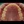 MTA orthodontics (Mini-Tube Appliance partial braces) — after (90days) · Make Dental Clinic