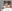 裏ハムラ法（経結膜的眼窩脂肪移動術） — ウィバース美容外科クリニック