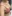 Breast augmentation with implants — Eight Plastic Surgery Clinic