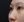 ผ่าตัดเอาสิ่งแปลกปลอมออกจากจมูก (เอาซิลิโคนจมูกออก) — ก่อนทำ (30วัน) · คลินิกศัลยกรรมตกแต่งอีเอสชองดัม