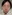 団子鼻修正（鼻尖縮小術） — オブジェ美容外科クリニック
