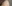 額縮小術（生え際下げ・ヘアライン下降術） — バタン美容外科クリニック