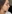 revision rhinoplasty — Coco Line Clinic