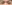 二重まぶた（自然癒着法） — ネイチャーオン美容外科クリニック
