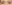 涙袋形成（脂肪注入） — ファクト美容外科クリニック