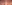 裏ハムラ法（経結膜的眼窩脂肪移動術） — オブジェ美容外科クリニック