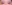 二重まぶた（自然癒着法） — アーバン美容外科クリニック