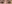 二重まぶた（自然癒着法） — プロミス美容外科クリニック
