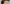 生え際アートメイク（ヘアラインアートメイク） — TOP美容外科クリニック