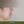 ศัลยกรรมยกริมฝีปากบน (Lip Lift) — หลังทำ (5วัน) · คลินิกเสริมความงามคลีฟ