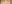 裏ハムラ法（経結膜的眼窩脂肪移動術） — ファクト美容外科クリニック