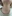 鼻尖形成術（自家軟骨移植） — ヒューマン美容外科