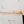Arm liposuction — before (7days) · D-Light Surgery Clinic