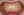 Metal bracket braces (traditional fixed orthodontics) — after (123days) · Yeonse Bareun Dental Clinic