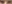 裏ハムラ法（経結膜的眼窩脂肪移動術） — ファクト美容外科クリニック