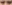 裏ハムラ法（経結膜的眼窩脂肪移動術） — ファクト美容外科クリニック