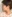 鼻尖形成術（自家軟骨移植） — ハイエンド美容外科クリニック