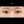 ผ่าตัดแก้ขนตาทิ่มตา (ขนตาแยงตา / เปลือกตาม้วนเข้า) — ก่อนทำ (20วัน) · รพ.ศัลยกรรมตกแต่งโอลโล