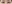 切開法（全切開法二重術） — IK美容外科クリニック