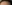 額縮小術（生え際下げ・ヘアライン下降術） — ザフィックス美容外科クリニック