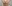 額（おでこ）のヒアルロン酸注入 — プラデン美容外科クリニック