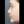 revision rhinoplasty — before (7days) · Anersty Plastic Surgery Clinic