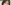 二重まぶた（自然癒着法） — ルホ美容外科クリニック