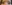 埋没法（二重埋没法） — プロミス美容外科クリニック