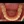 Orthodontic treatment (braces) — after (60days) · Make Dental Clinic