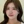 ผ่าตัดแก้ไขภาวะลิ้นจมูกตีบ/ยุบ (Nasal valve stenosis) — ก่อนทำ (21วัน) · เอ็นพลัสคลินิก
