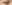 二重まぶた（自然癒着法） — フルルン美容外科クリニック