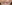 唇のヒアルロン酸注入（リップヒアルロン酸） — 私的な美しさ Jiyuクリニック