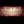MTA orthodontics (Mini-Tube Appliance partial braces) — after (90days) · Make Dental Clinic