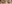 二重まぶた（自然癒着法） — プロミス美容外科クリニック