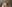 buried suture (non-incisional) double eyelid surgery — Chai Plastic Surgery