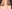 Ptosis Correction (levator surgery / eye-shape correction) — Luho Plastic Surgery Clinic