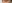 裏ハムラ法（経結膜的眼窩脂肪移動術） — ジャスト美容外科クリニック