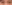 裏ハムラ法（経結膜的眼窩脂肪移動術） — ウリ美容外科クリニック