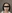 Mini facelift (short-scar, limited-incision facelift) — Uri Plastic Surgery Clinic