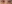 裏ハムラ法（経結膜的眼窩脂肪移動術） — ファクト美容外科クリニック