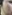 Pico Toning (picosecond laser toning) — Planner Plastic Surgery Clinic