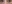 切開法（全切開法二重術） — オロ美容外科クリニック