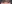 二重まぶた（自然癒着法） — ルホ美容外科クリニック