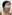 facial contouring injection (facial fat-dissolving injection) — Uline Clinic