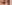 二重まぶた（自然癒着法） — フルルン美容外科クリニック