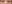 裏ハムラ法（経結膜的眼窩脂肪移動術） — ファクト美容外科クリニック