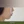 ศัลยกรรมยกริมฝีปากบน (Lip Lift) — หลังทำ (5วัน) · คลินิกเสริมความงามคลีฟ
